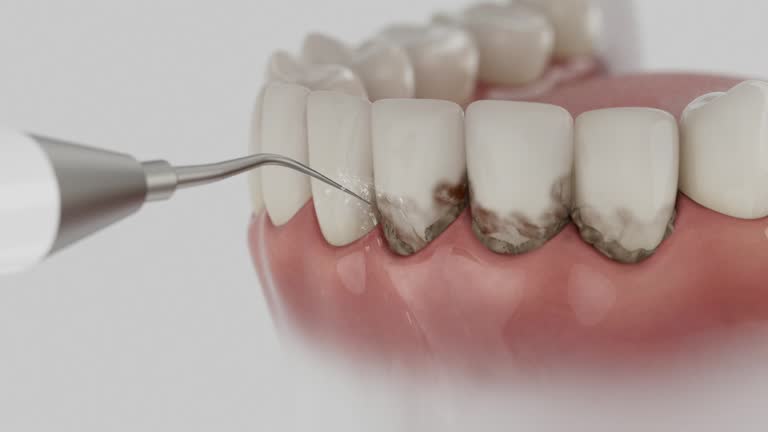 Reliable Dental contractor in Wilmington, OH by Dentist Open Now